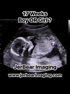 Boy OR Girl?  #jerbearimaging #17weekspregnant #secondtrimester #boyorgirlwhoknows #girlorboy #blueorpink #fyp #boyorgirl #genderultrasound #genderreveal #baby #newmoms #newmomlife #dadtobe #momtobe #brownwoodtx www.jerbearimaging.com