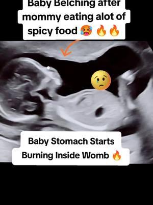 Baby Belching after mommy eating alot of spicy food during Pregnancy #babyultrasound #acidityproblem #acidityinpregnancy #pregnancyacidreflux #babyultrasound #babykicks👣 #babyultrasound🤰✔️ #babyultrasound👣💙 #babykicksgettingstronger #babyultrasoundscan 