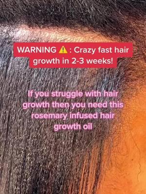 Shop on curlzgalore.com #viral #naturalhair #ayurvedichaircare #indianhaircare #hairgrowthoils #hairconditioner #rosemaryhairoil #naturalhaircare #boxbraids 