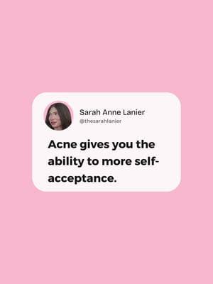 #acne #acnepositivity #skinpositivity #acnecommunity #acneawareness #acneacceptance #acnejourney #acnesupport #acneempowerment #acneconfidence #cysticacne #acnescar #acnetreatment #acnefree #acnesolutions #acnecare #acnehealing #acnestruggles #acneskin #acneproblems #acnetips #acnelife #acnestory #acnerealtalk #acnetruth #acnerecovery #acneawarenessmonth #acneconfidence #acnehealing #acneinspiration