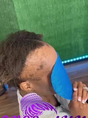 https://evelastyngrip.com/ IM LOCATED IN MARIETTA GEORGIA  https://evelastyngrip.com/(Cover up style ) 🤏🏾💪🏾🥰 #alopecia braider #alopeciaareataawareness #alopeciatreatment #braidstyles #alopecia #coverupbraids #hairrestoration #hairdresser