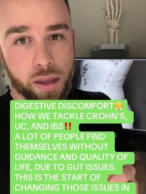 IBS, CROHNS, UC  #ibs #crohnsdisease #crohns #uc #ulcerativecolitis #helicobacterpylori #guthealth #candida #sibo #gerd #gastritis #ibs  #leakygut #digestivehealth #acidreflux #bloating #helicobacter #guthealing #chronicillness #gastro #heartburn #cancer #crohnsdisease #endoscopia #exames #healyourgut #ulcerativecolitis #guthealth #fyp #fypシ #fypシ゚viral #longervideos #viralvideo 