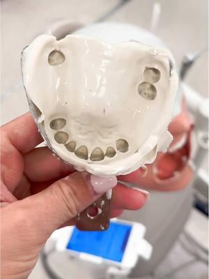 Let the dental school games begin… first up: blind folded impressions🦷 #dentalschool #marquetteuniversity #marquette #dds #impressions #alginate #alginateimpression #dentist #dentistry #simlab 