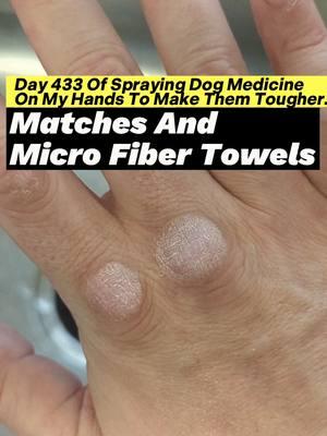 Day 433 Of Spraying Dog Medicine On My Hands To Make Them Tougher. Matches And Micro Fiber Towels. #roughhands #dogmedicine #ironfist #martialarts #sandpaper #boxing #ballisticdummy #badmintontraining #toughhandspray #dogspray #softhands #bluecollar #asmr #oddlysatisfying #microfibertowel #skincareroutine #fistofthedogmedicine #fyp 