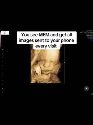 Just a few more weeks 🥹😭 I hope #mfm #maternalfetalmedicine #specialists #ultrasound #ultrasounds #baby #babygirl #babyboy #imaging #funny #jokes #healthy #health #highrisk #highriskob #highriskpregnancy #pregnant #mom #momlife #momtok #fyp #bingbop #bam #cutie #facepics #firstpictures #scans 