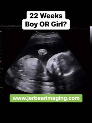 Can you guess?  #jerbearimaging #ultrasoundnearme #22weekspregnant #imagingcenter #fyp #girlorboy #boyorgirl #pinkorblue #blueorpink #heorshe #pregnantbelly #brownwoodtx www.jerbearimaging.com