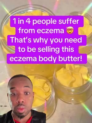 Comment “BEAUTY” for me to do a FREE 🆓 CLASS on how to start a business in a weekend!  Dealing with eczema can be challenging, but our Eczema Honey Butter is here to bring you relief! This luxurious, all-natural formula is packed with powerful ingredients that soothe, hydrate, and heal your skin.  #eczema #skin #tiktokdoc #LearnOnTikTok #skincaretips #eczematreatment #eczemaawareness #eczemacommunity