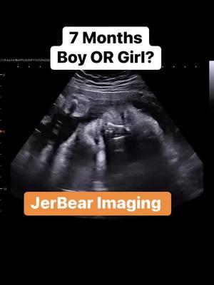 Can You Guess? #jerbearimaging #blueorpink #boyorgirl #fyp #heorshe #pinkorblue #7monthspregnant #growingbaby #momtobe2025 #dadtobe2025 #girlorboy #babyonboard #brownwoodtx #imagingcente www.jerbearimaging.com