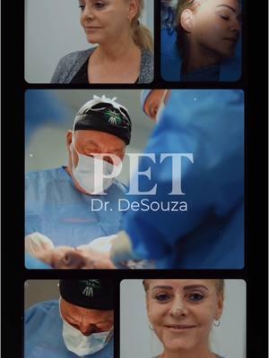 ✨ Ready for a change? The PET Face Lift with expert 👨‍⚕️Dr. DeSouza is designed to rejuvenate your face, highlighting your natural beauty and giving you the confidence you deserve in 2025. 💖 🌟 Free consultations available 💳 Flexible financing options to fit your budget 📲 Message us on WhatsApp at (305) 602-2979 and start your journey to a refreshed and confident version of yourself. #PETFaceLift #DrDeSouza #cgcosmetic