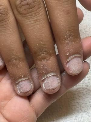 Nail transformation ##956 #rgv #rgvnailtech #rgvnails #956nails #956nailtech #rgvnailsalon #valleygirls #rgvgirlz #rgvnailtechs #nailtech #nailtechcheck #nailtechlife #nailtechtiktok #missiontx #altontx #lajoyatx #penitastx #sharyland #mcallentx #edinburgtx #sanjuantx #donnatx #hidalgotx #pharrtx #coquette #coquettenails #pink #pinknails 