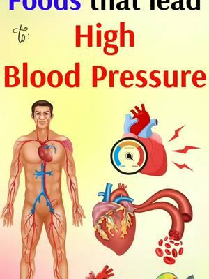 Foods that lead to high blood pressure (Hypertension) #highbloodpressure #bloodpressure #cholesterol #bloodpressurehigh #highbloodpressurediet #highbloodpressure #health #healthy #Meats #ProcessedMeats #salt #sodium #delimeats #sausages #bacon #Redmeat #hypertension #saturatedfat #SaltyFoods #CannedSoups #Vegetables #Bread #Rolls #diet #Pickles #foods #tasty 