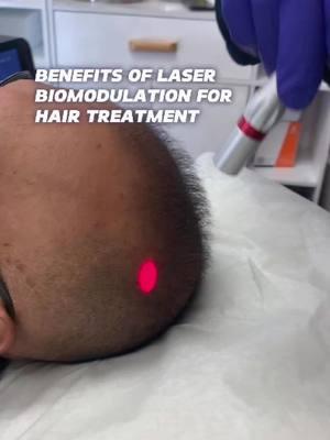 Laser bio modulation for hair restoration and stimulating the scalp is a great and easy tool to get your follicles stimulated for further growth and thickening.. contact us for more details! #hairrestoration #amazingdeals #newportbeach #laser #bestresults #pchmedspa #laserbiomodulation #losangeles #laserhairrestoration 