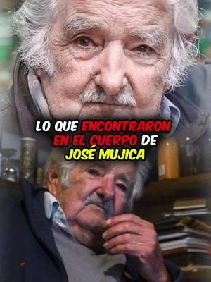 Lo que encontraron en el cuerpo de José Mujica.  #JoseMujica #cancerjosemujica