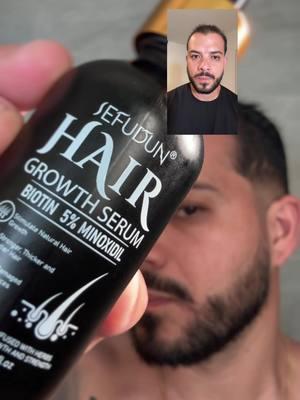 Este #serum para la #barba de sefudum, es mi mejor truco para el crecimiento del cabello por su fórmula biotin y minoxidil, acá te enseño cómo usarlo #serum #barba #serums #haircare #menhairgrowth #menhair #beardgrowth #beard #hairgrowth #minoxidil #beardstyle #haircareroutine #beardlook #beardmen #beardtok #viraltiktok #trendy 