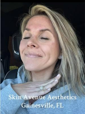 #SkinAvenueAesthetics #daxxify #botox #skincare #SelfCare 