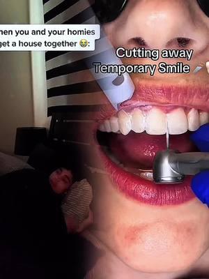 #dentalveneers#asmrteeth#breakingteeth#veneers#oddlysatisfyin#dentalveneers#naturalveneers#deepcleaning#teethcleaning#flossing