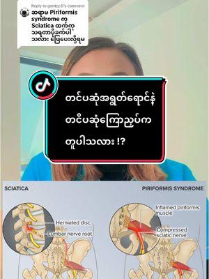 Replying to @gentzy.0 ဖြေပေးလိုက်ပါပြီနောါ #အာရုံကြောရောင်ခြင်း #တင်ပဆုံအာရုံကြောညှပ်ခြင်း #thandarhealthtips #healtheducation #ဆရာမသန္တာ 