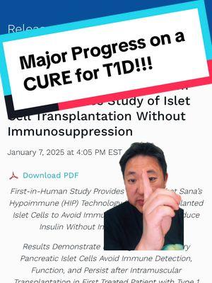 In a major step closer toward establishing a CURE for Type 1 Diabetes, Sana Biotechnology just announced MAJOR news where a person with T1D was the first human EVER to receive islet cell transplants WITHOUT immunosuppression. Their HypoImmune Technology (HIT) uses CRISPR gene editing to modify transplanted islet cells to evade the immune system.  This is a huge deal because a cure for T1D requires two major goals: 1. Restore insulin production 2. Protect that insulin production from destruction by the immune system Previously, there had only been major progress with goal #1, primarily through Vertex Pharmaceuticals and their success in implanting Stem Cell-derived islet cell (which produce insulin) in humans. These have been so successful that many of their subjects no longer require injected insulin. However, a major limitation to this product was that subjects required lifelong immunosuppression, which has major risks and potential long-term safety concerns.  This study by Sana is meaningful because it is the first successful (so far) attempt at creating a solution that avoids destruction by the immune system. While this study utilized islet cells from a deceased human donor (which is not a long-term solution because these are hard to come by), the HypoImmune Technology (HIT) should theoretically be usable for stem-cell derived islet cells (which are able to be produced in large quantities), whether they are made by Vertex or Sana (who is working on their own stem-cell derived islet cells).  #t1d #medtronicdiabetes  #tandemdiabetes #jdrf #Omnipod5 #omnipod #apitiktok #TikTokPartner 