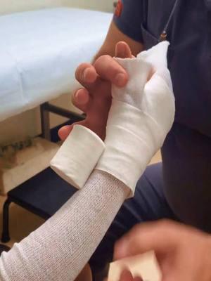 The Doctor Strange Help Patient Cast Arm In Hospital 😱 #cast #casting #brokenarm #castarm #brokenbone #fyp #emotional #doctorstrange #helps #hospital #satisfying 