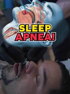 This patient suffers from severe sleep apnea and came in seeking better breathing relief.  Watch this incredible session!  —————————————————————— Este paciente sufre de apnea del sueño severa! Vino a la oficina buscando respirar mejor! Mira cómo se sintió después! . . . #SleepApnea #BetterBreathing #ChiropracticCare #FaceCrack #chiropractor #apneadelsueño 