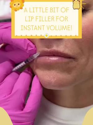 As you’re filling the lips, it’s important to assess your patient and pay close attention to the way the tissue is filling! 🌼👄 Learn how to do this and much more at facialesthetics.org  Learn it. Live it. Give it!  Get AAFE Certification trained today! ° °  ° #AAFE #aafecertified #esthetics #facialesthetics #botox #filler #education 