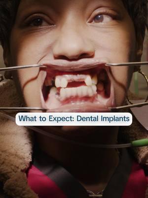 When it comes to implants, we design them to last a lifetime—so you can smile with confidence for years to come. #AspenDental #smiletransformation #highqualitycare #patientfirst #dentist #dentalimplant