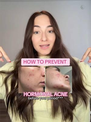 How to prevent hormonal acne before your period! #skincare #skin #skincareroutine #acne #acnescarring #skinbarrierrepair #acnescars #acnetreatment #skintok #clearskintips #skincareresults #acnebeforeandafter #clearskinproducts #skinbarrier #skincaretips #clearskin #clearskinroutine #hormonalacne #hormonalimbalance #balanceyourhormones #accutane 