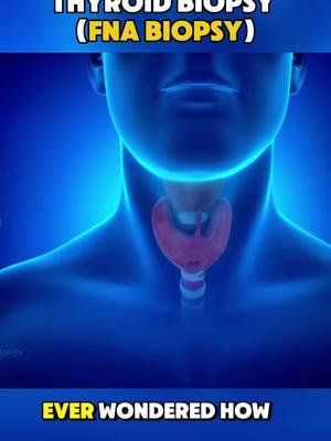 Thyroid FNA Biopsy Medical Animation 3D #thyroidbiopsy #biopsy #thyroidproblems #thyroidhealth #thyroidism #fnabiopsy #medicalanimation 