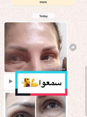 #تجاعيد_تحت_العيون #شدالجفن_العلوي #skincareroutine #nobotox #nofillerneeded #antiaging #بديل_البوتوكس_والفلير #skincarefyp #ترهلات_البشرة #ازاله_التجاعيد #follow #suscribe #numberinbio☎️ #mirabelle #glowyskin #eyecare #eyecream #eyebotox 