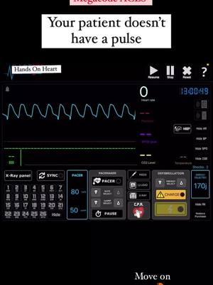 Megacode ACLS! According to the AHA 2020 ACLS. #ekg #ecg #ekginterpretation #ecginterpretation #acls 