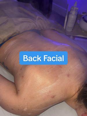 Back Facials can help you address Back-ne concerns. We will exfoliate your skin using Microdermabrasion, perform extractions, use high frequency to help kill bacteria & use a calming or hydrating mask. Clear skin is an appointment away. 📍222 Wilshire Blvd. Casselberry, FL ☎️407-403-9549 🌐cityescapespa.com #cityescapespa #backfacialtreatment #casselberryspa #orlandoskincare #acneproneskin #orlandoesthetician 