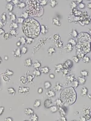 just a hungry little macrophage.  #urinalysis #medlabscientist #healthcareworker 