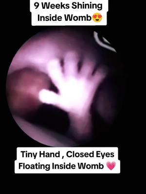 9 weeks baby shining inside Womb during ultrasound scan #babyinsidemytummy #babyinside #babyinsidebelly #babykicksinmytummy #babyinsidethewomb #9weeks #9weekspregnant #9weekspregnancy #9weeksinside 