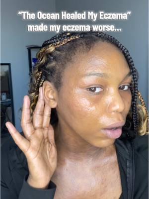 If you have severe eczema, do yourself a favor and DO NOT purchase this cream!!! I know everyone’s skin barrier is different but I’d never be able to recommend this product in good conscience. #theoceanhealedmyeczema #BlackTikTok #blackgirltiktok #eczema #donotbuy #honestreview #productreview #eczemaflareup 