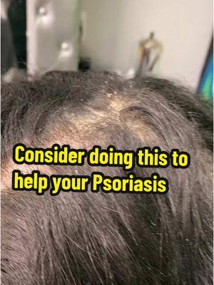 Check out the Scalp Cleanse it is great for #psoriasishelp #psoriasis #dermatitis #dandruff #itchyscalp #diet #wellness #scalppsoriasis 