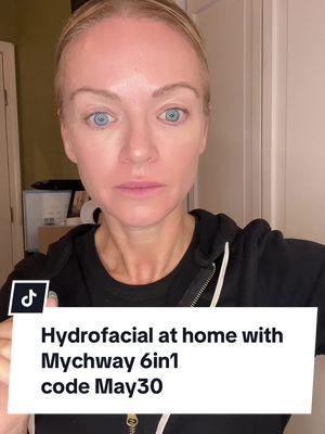 6 in 1 Hydro Dermabrasion Machine by Mychway - At Home Spa Treatment #hydrodermabrasionfacial #hydrodermabrasion #ultrasonicskinscrubber #oxygenatedwater #microcurrentfacial #hotdrum #colddrum #skincareover40 #athomespatreatment #mychway @superlucky_bestie @mychway 