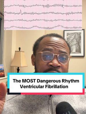 The most dangerous rhythm I’ve ever seen! #VentricularFibrillation #Cardiac #Rhythm #EKG #ECG #Cardiology #TikTokPartner #Hospital #acls #medical #heart 