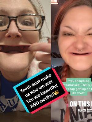 #duet with @MamaUpInSmoke🦁 First off IM NOT SORRY!!! #rememeber #mamaupinsmokefamily #mamaupinsmoke #dentures #denturegang #denturesatayoungage #toothless #toothlessbeauty #gummy #gummygang #gummies #beautiful 