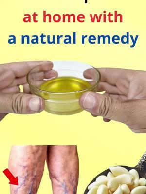 Relieve pain at home with a natural remedy #naturalremedy #painrelief #athometreatment #healnaturally #homecaretips #healthylifestyle