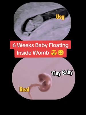 6 weeks baby floating inside Womb #babyultrasound🤰✔️ #babyultrasound👣💙 #babyinside #babyinsidebelly #babykicksinmytummy #babyinsidethewomb #babyinsidemytummy #6weeksold #6weeks #6weekspregnant 