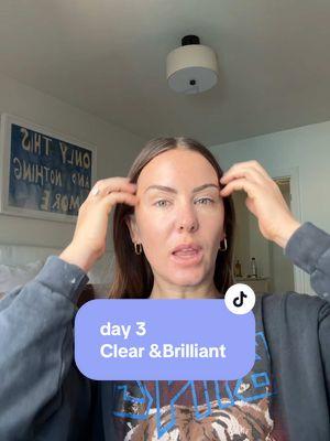 Patiently waiting for day 5! #clearandbrilliant #skintok #bridalskincare #skincaretips #bridetok #skinprogress #GlowUp 