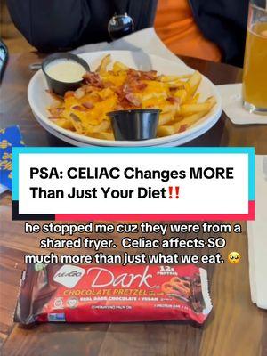 What was a moment that made you realize celiac / eating gluten free would change MUCH MORE than just your diet? 🥺🤔👇 I will always remember the first time I went out to eat with my family post-celiac & realized I couldn’t steal off their plates or order without going into a whole celiac spiel on gluten & cross contact. 😅 And honestly, this statement is true of any food allergy or dietary restriction. 🫶 They change how we socialize…how we date…how often, where or IF we ever eat out to have a break from cooking…how we travel…what work events we attend and SO much more. 🤷‍♀️ So if you’re having a hard time with celiac or a gluten free diet today, know you’re not alone and I’m thinking of you. 🫶  What do YOU think the hardest part about living with celiac disease / needing a gluten free diet is? 🤔 Would be curious to hear 👇 Venting always welcome. 🫶 #celiactiktok #glutenfreefood #glutenfreelife #glutenfreeliving #celiaclife #foodallergies #nogluten #foodallergy #glutenfree #coeliac #celiacos #glutenfreebread #celiac #glutenfreedessert #chronicillness #autoimmune #autoimmunedisease 