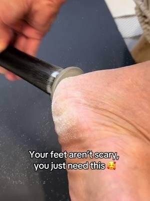 Seriously, how did I not know this existed #foryoupage #fyp #goviral #footfile #electricfootfile #footcallusremoval #feetcare #beautyproducts #pedicure #tool #callusremoval #tiktokshopfinds 