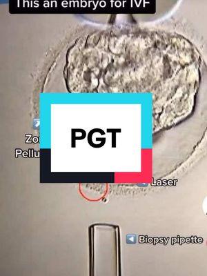 PGT is a powerful technology that helps us determine if the embryo has the right amount of DNA to make a baby! #pgt #ivf #genetics #fertility #pregnancy 