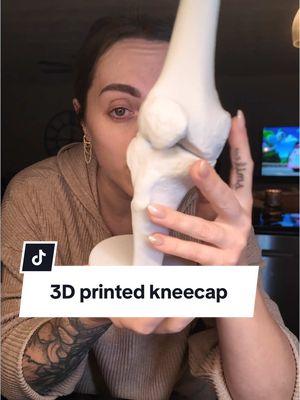 If he wanted to he would. #3dPrints #bambulabs #brokenkneecap #kneesurgery #brokenknee