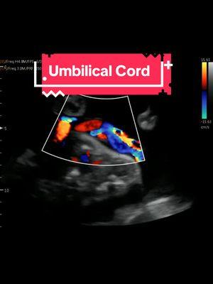 isn't it amazing?! #heybabymobile #baby #pregnant #pregnancy #30weeks3dayspregnant #rochesternyultrasound #2dultrasound #umbilicalcord #cordbloodflow www.HeyBabyMobile.com 