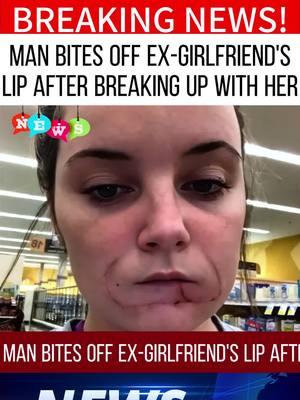 Man bites off ex-girlfriend's lip after breaking up with her.#news #fypシ゚viral #foryou #tiktok #tiktoknews #breakingnews #fy #crime 