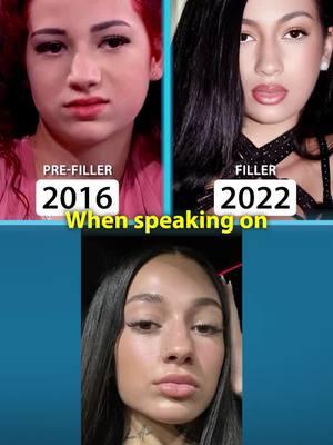 Why Bhad Bhabie Dissolved Her Filler #BhadBhabie #celebrity #filler #PlasticSurgery #PlasticSurgeon #Surgeon