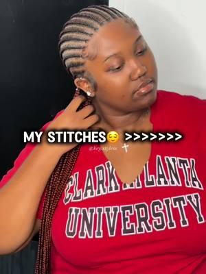 Tag your fav stitch braider 🫶🏾 STYLE: Straightbacks x Butt Length  February Opening Soon💓 • #stitch #straightbacks #atlstitch #knotless #atlbraider #atlknotless #smallstitch #cutcreatersalonsuites