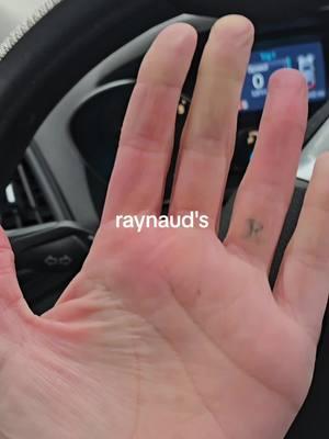 ouch #raynauds 